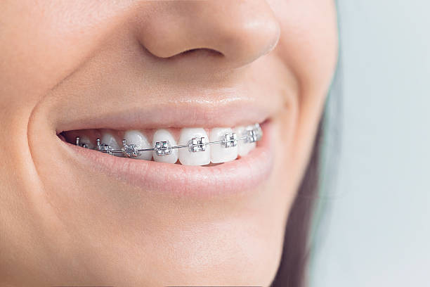 Best Root Canal Treatment  in San Clemente, CA